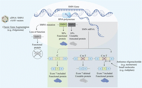 図3. SMAの遺伝子治療