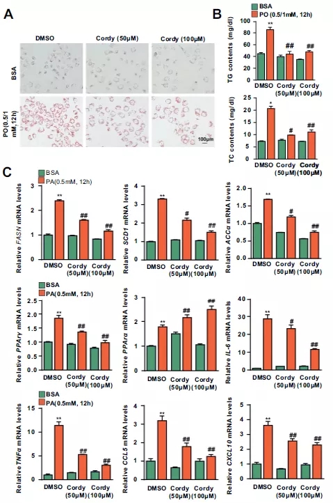 図1. 肝細胞の脂質蓄積と炎症に対するコルジセピンの影響 | Cyagen Japan