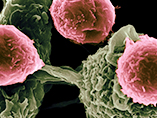 固形腫瘍治療におけるCAR T療法の研究進展