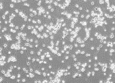 None Sprague-Dawley (SD) Fetal Rat Cortex Neurons SCCFN-00001-2