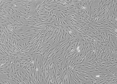 None Human Adipose-Derived Mesenchymal Stem Cells HUXMD-01001
