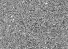 None Rabbit Adipose-Derived Mesenchymal Stem Cells RBXMD-01001
